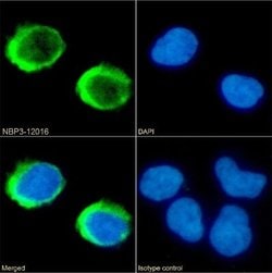 CD40 Ligand/TNFSF5 Rabbit anti-Human, Clone: IDEC-131 (Toralizumab), Novus
